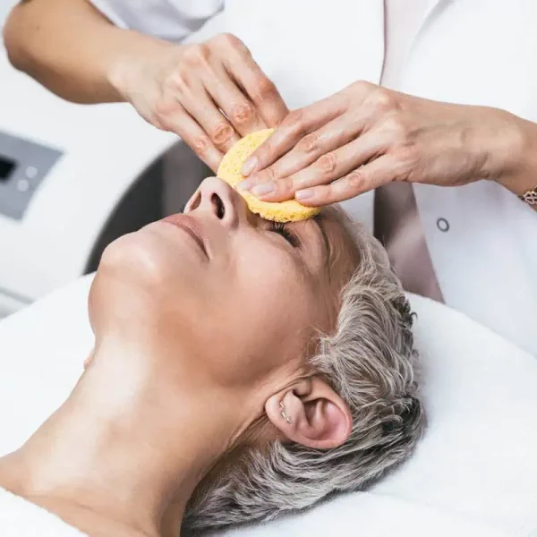 Chemical Peels-in-Rochester-IN